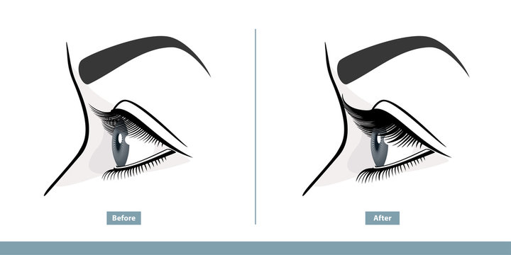 Female Eye Before and After Eyelash Extension. Comparison of Natural and Volume Eyelashes. Side View. Infographic Vector Illustration