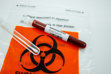 Closeup of a positive blood test result for coronavirus and cotton swab for testing COVID-19 on top of a biohazard bag. Concept of covid19 pandemic kit test.