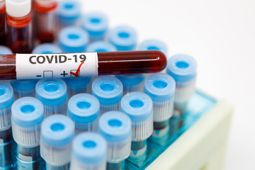 Close up of test tubes rack with positive blood sample for coronavirus, covid-19 virus. Coronavirus positive blood sample tube.