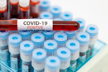 Close up of test tubes rack with positive blood sample for coronavirus, covid-19 virus. Coronavirus positive blood sample tube.