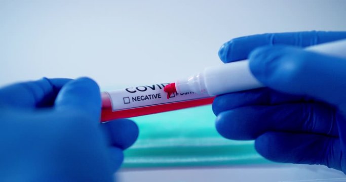 Medical lab worker with blue surgical gloves marking positive blood samples tube testing for coronavirus Covid-19 (2019-nCoV) shot in 4k super slow motion