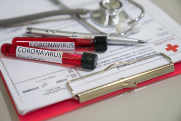 Coronavirus blood test in hospital laboratory.
