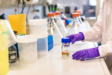 Close up hands in gloves holding urine test tube