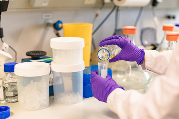 Close up of doctor's hands pours liquid into flask