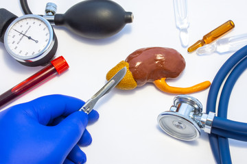 Concept photo of adrenal surgery, operation of adrenalectomy or removal. Doctor with scalpel in hand makes incision in figure of human adrenal, which is located near medical toolkit - stethoscope