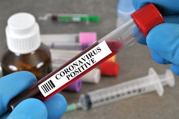 Coronavirus positive blood test