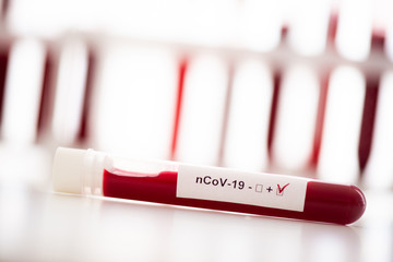 Test tube with blood sample for COVID-19 test, novel coronavirus 2019. Concept of vaccination,...