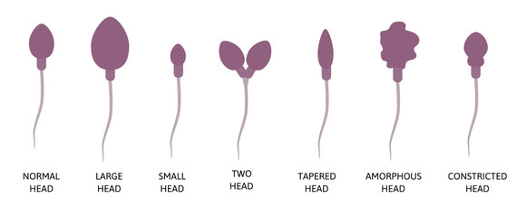 Spermogram and semen parameters, teratozoospermia, normal and abnormal sperm. Head defects spermatozoon.