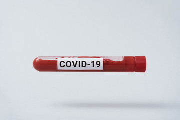 Minimal shot of COVID-19 test and laboratory sample of blood testing for diagnosis new Corona virus infection(novel corona virus disease). Pandemic infectious concept.