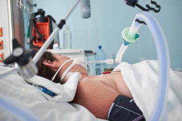 Intubated woman with ventilator assisted breathing due to flu or coronavirus pneumonia - obrazy, fototapety, plakaty