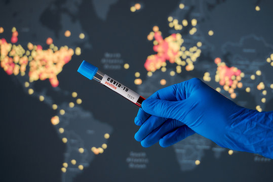 A hand of a doctor holding a positive coronavirus blood sample against a world map. A world map with confirmed cases of COVID-19. Coronavirus disease 2019 situation update worldwide spread.