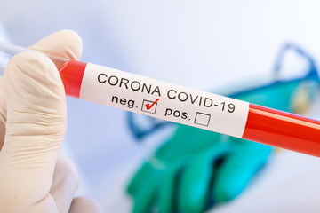 CORONA Virus