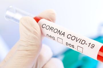 CORONA Virus