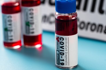 Virus disease lab covid-19 sample,  research.