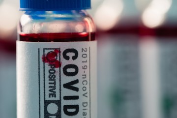 Virus disease lab covid-19 sample,  wuhan.