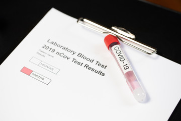 Laboratory results for nCov - 19 positive negative