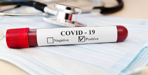 Coronavirus blood test concept.  Test tube with coronavirus positive blood over laboratory desk