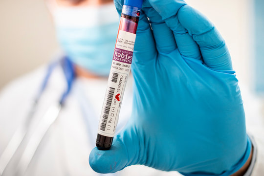 Doctor holding test tube blood sample