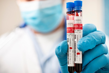 Doctor holding test tubes blood samples