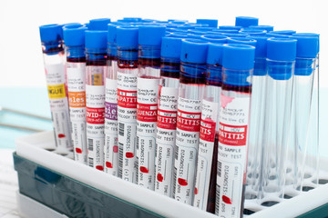 Several infected blood samples