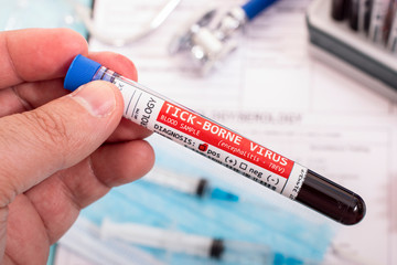Fototapeta premium Blood samples with infected virus