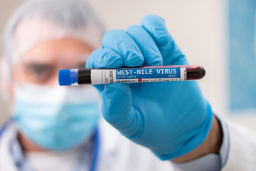 Doctor holding test tube blood sample