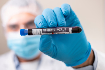 Doctor holding test tube blood sample