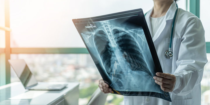 Doctor diagnosing patient’s health on asthma, lung disease, COVID-19 or bone cancer illness with radiological chest x-ray film for medical healthcare hospital service