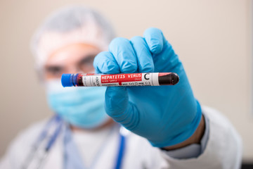 Doctor holding test tube blood sample