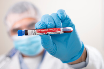 Doctor holding test tube blood sample