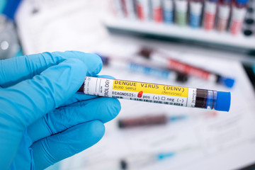 Blood samples with infected virus