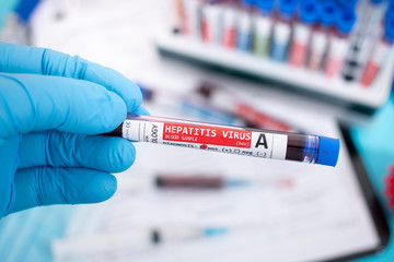 Fototapeta premium Blood samples with infected virus