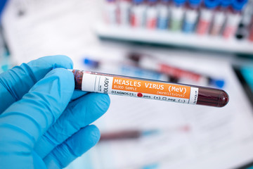 Blood samples with infected virus