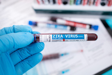 Fototapeta premium Blood samples with infected virus