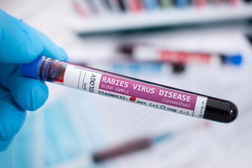 Fototapeta premium Blood samples with infected virus