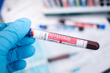 Fototapeta premium Blood samples with infected virus