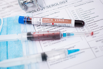 Blood samples with infected virus