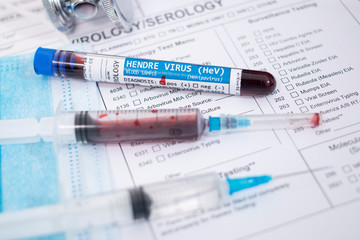 Blood samples with infected virus