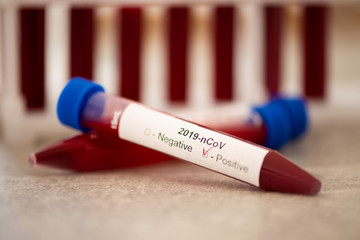 Test tube with blood sample for COVID-19 test, novel coronavirus 2019. Concept of vaccination,...