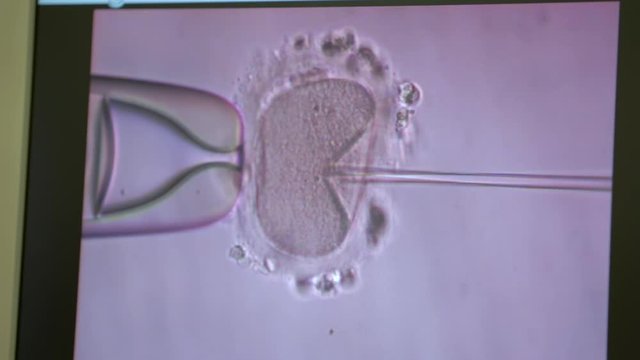 Filming of process of fertilization of female egg, sperm penetrates, genetics, IVF, gynecology, conception of new life, laboratory manipulations, under microscope, precise movement, human population