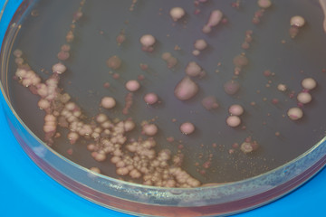 bacterial colonies   on  agar   medium petri dish plate plate on MacConkey agar