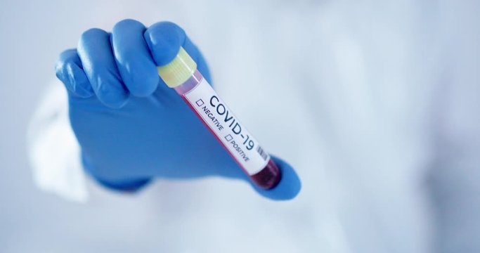 Medical lab worker with blue surgical gloves shaking blood samples tube testing for coronavirus Covid-19 (2019-nCoV) shot in 4k super slow motion