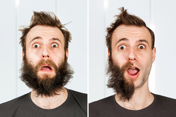 guy with half beard and without hair loss. Man before and after shave or transplant. haircut set...