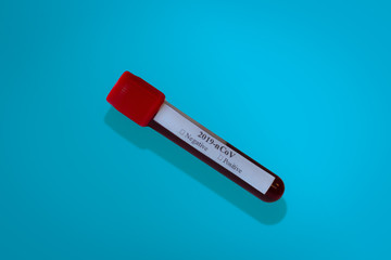 Koronawirus in hand.