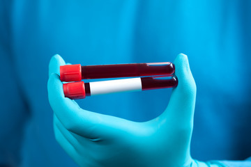Coronavirus 2019-nCoV Blood Sample.