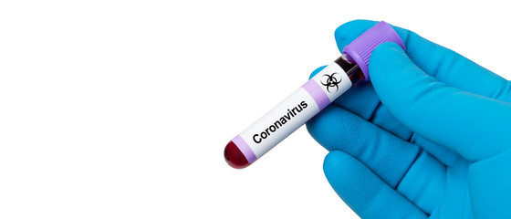 Fototapeta premium Coronavirus 2019-nCoV Blood Sample.