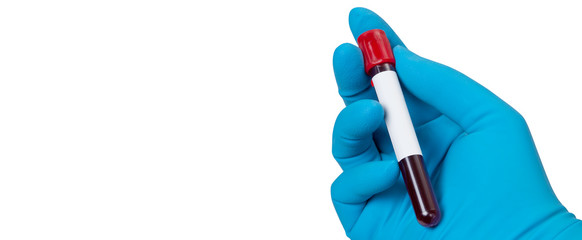 Coronavirus 2019-nCoV Blood Sample.