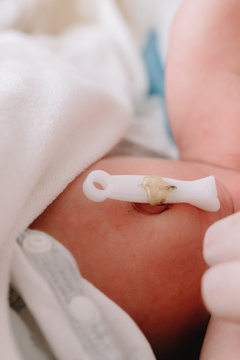umbilical cord of newborn baby