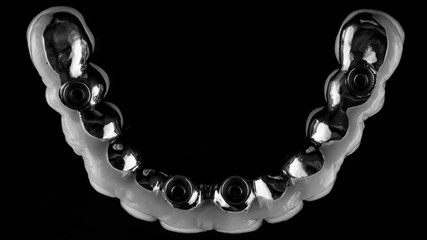 Top view of a titanium beam and a finished denture of the upper jaw, shot in black and white style © Dental Pro Content