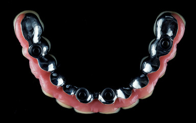 Top view of a titanium beam and a finished denture of the upper jaw, shot on a black background © Dental Pro Content